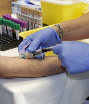 Varicose Vein Treatment (2)