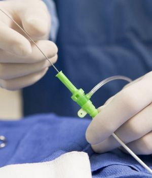 embolization procedure