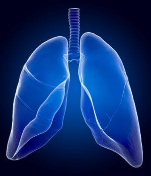 Pulmonary Embolism (PE) Treatment (2)