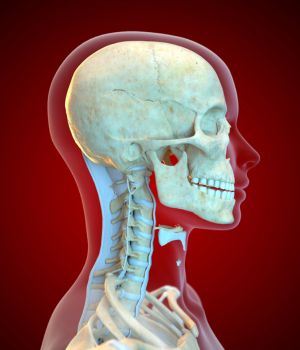 Thoracic Outlet Syndrome (TOS)
