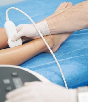 Vascular Ultrasound Evaluation