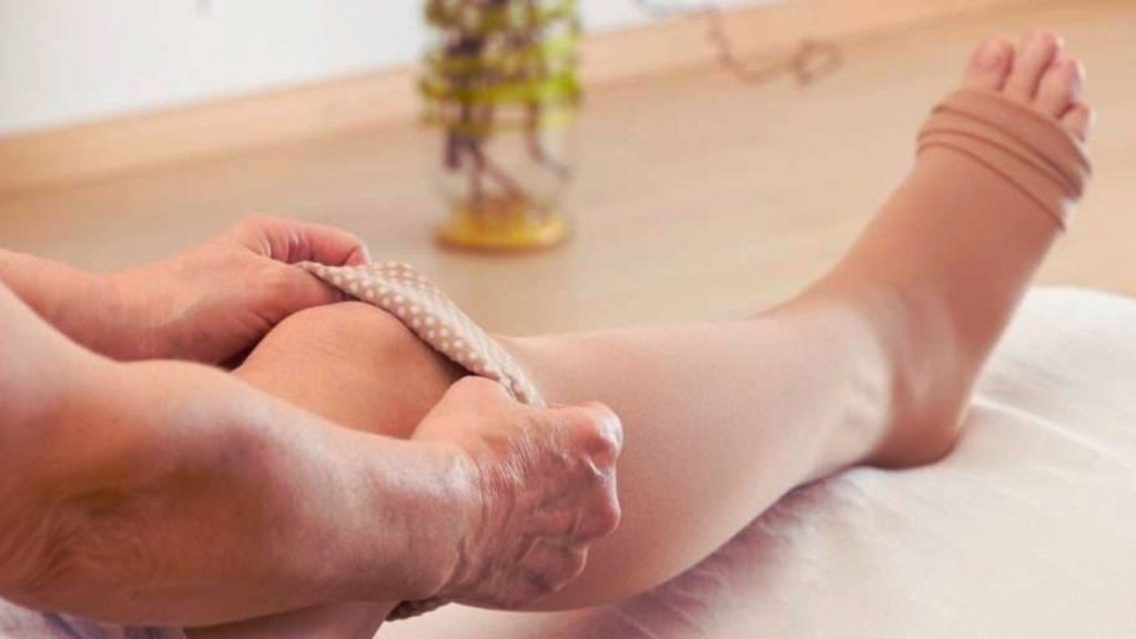 How to Relieve Varicose Vein Pain