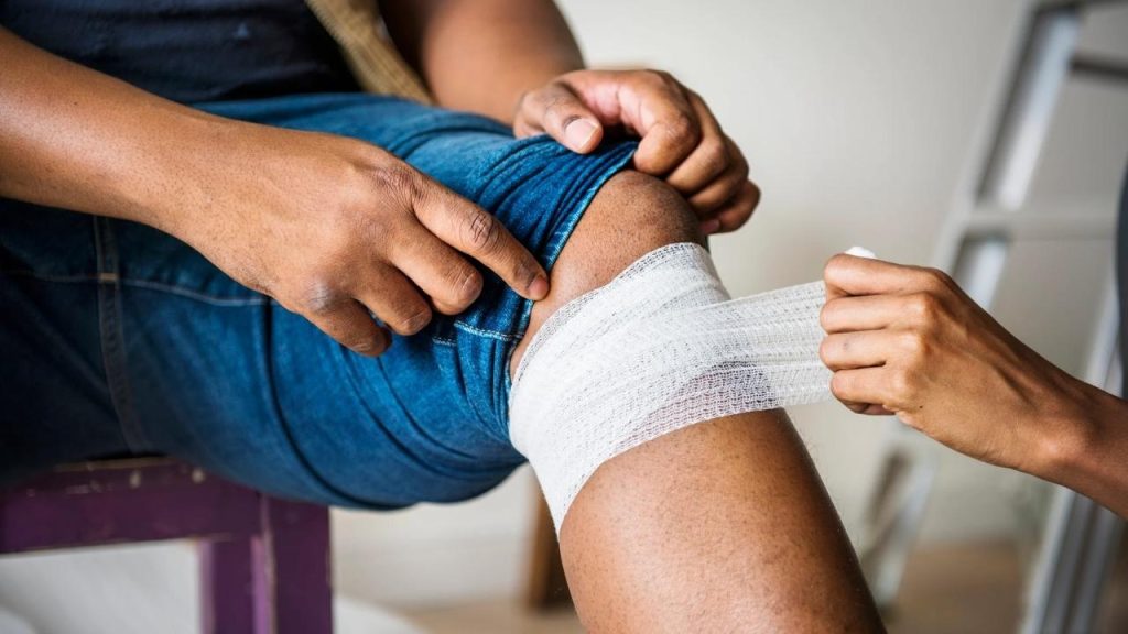 What to Expect After Varicose Vein Surgery
