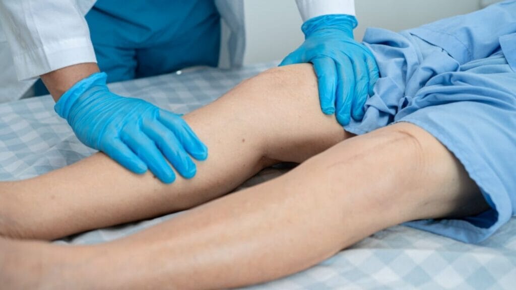 what is the best treatment for varicose veins in legs