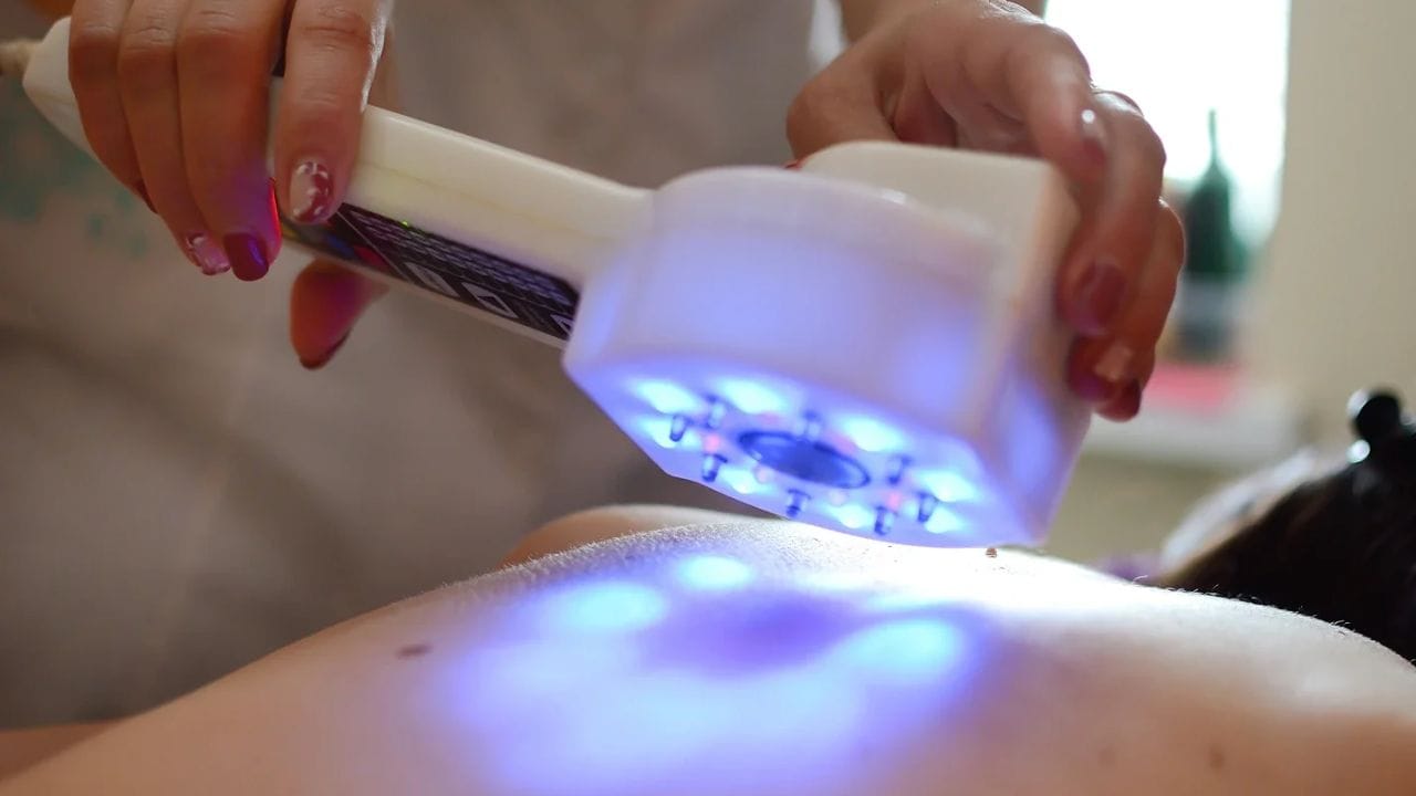 Blue Light Laser Therapy for Spider Veins