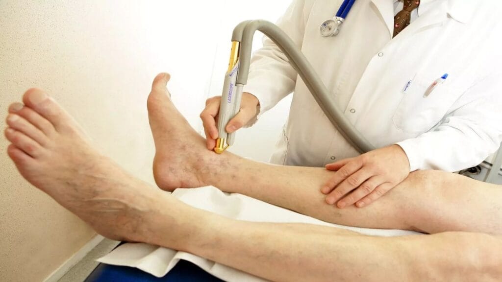 Does Laser Therapy Work on Varicose Veins