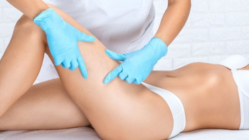 How To Select A Spider Vein Treatment Cosmetic Procedures