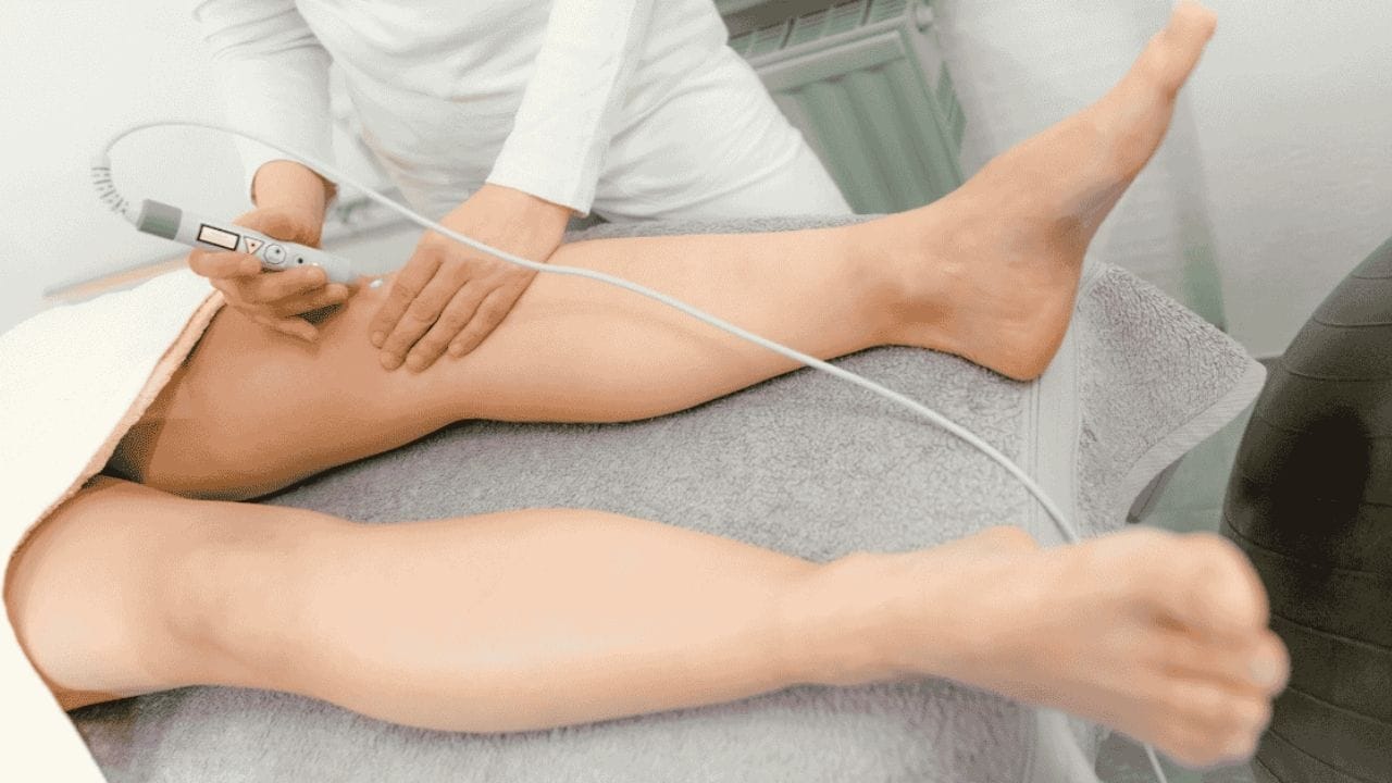 Sclerotherapy vs Laser Therapy for Spider Veins