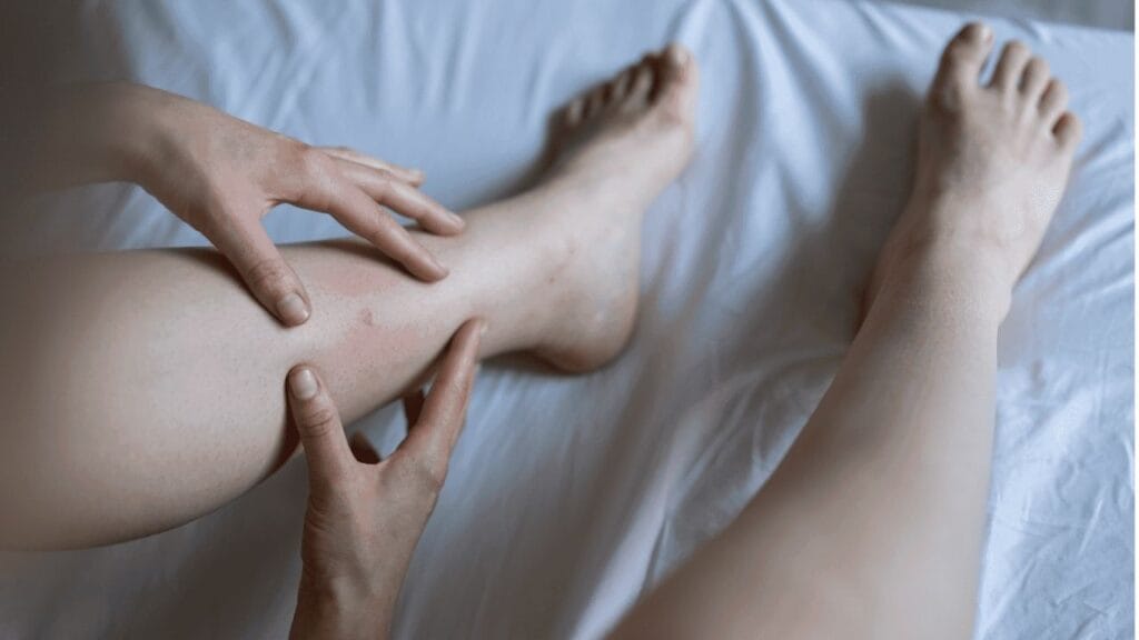 Can Chronic Venous Insufficiency Be Reversed