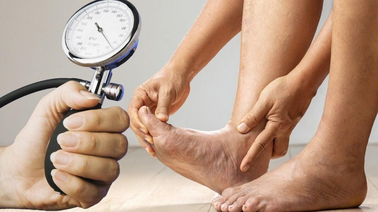 Can Venous Insufficiency Cause High Blood Pressure